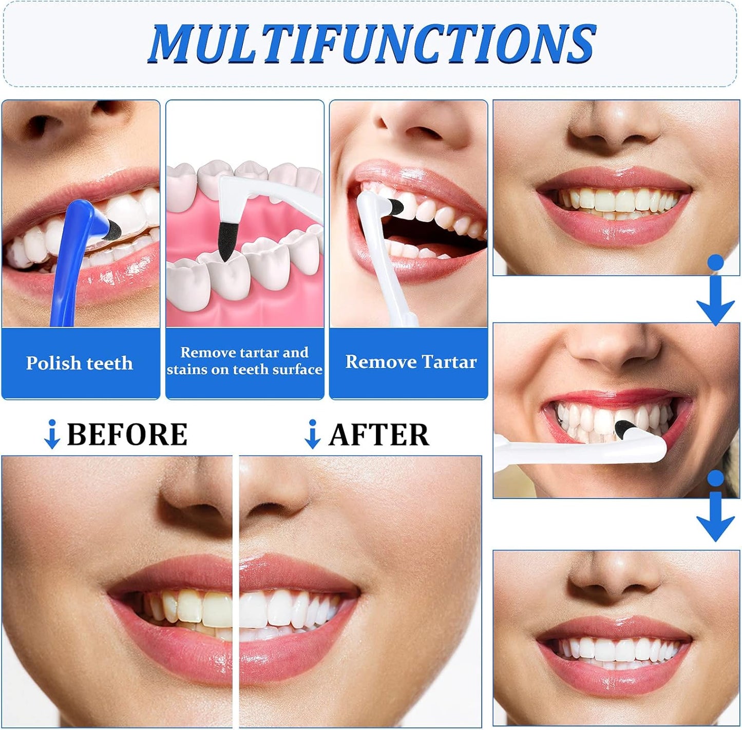 Geiserailie 8 Pieces Tooth Stain Eraser Tooth Stain Removers Tartar Remover Plaque Remover for Teeth Dental Polisher Cleaning Kit for Whitening Polishing