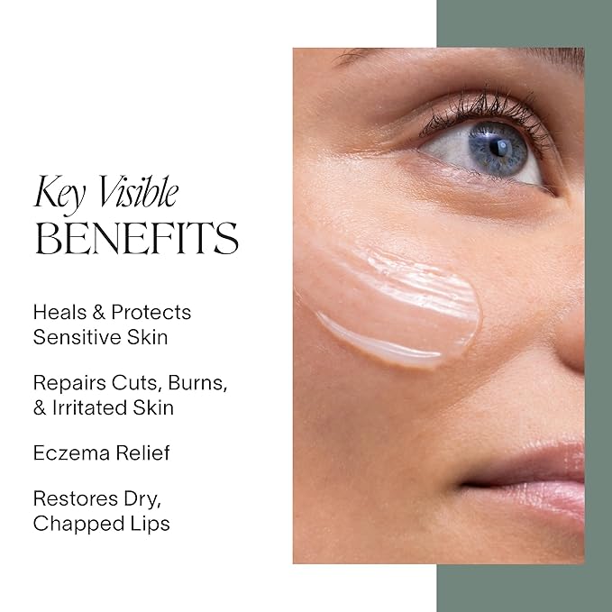 Doctor Rogers Restore Healing Balm. Multi-Purpose Healing Ointment & Moisturizing Eczema Relief Gel. Protects & Soothes Injured, Sensitive & Dry Skin, 1 Ounce (28 g) Jar