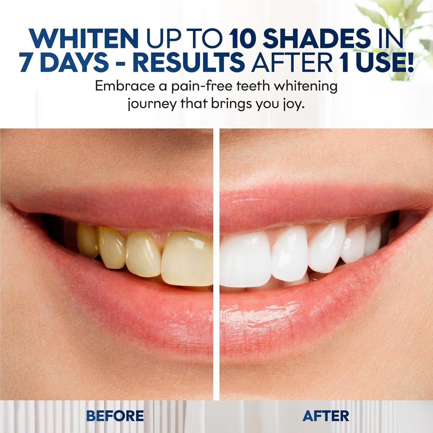 Chloe’C Teeth Whitening Strips | 7 Mint-Flavored Treatments for Sensitive Teeth | Non-Toxic Whitening Strips | Enamel Safe & Peroxide-Free | Removes Stains in 7 Days | Gentle-Effective Teeth Whitening