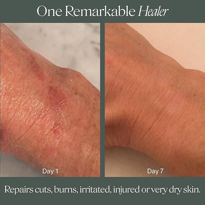 Doctor Rogers Restore Healing Balm. Multi-Purpose Healing Ointment & Moisturizing Eczema Relief Gel. Protects & Soothes Injured, Sensitive & Dry Skin. 4 Ounce (114 g) Tube