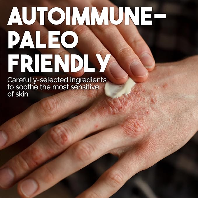 BALM OF GILEAD Manuka Eczema Honey Cream - Moisturizer for Sensitive Skin, Eczema, Psoriasis & Dermatitis - Manuka Honey Ointment, Grassfed Tallow